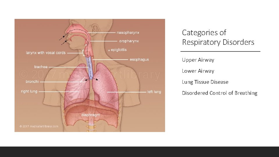 Categories of Respiratory Disorders Upper Airway Lower Airway Lung Tissue Disease Disordered Control of