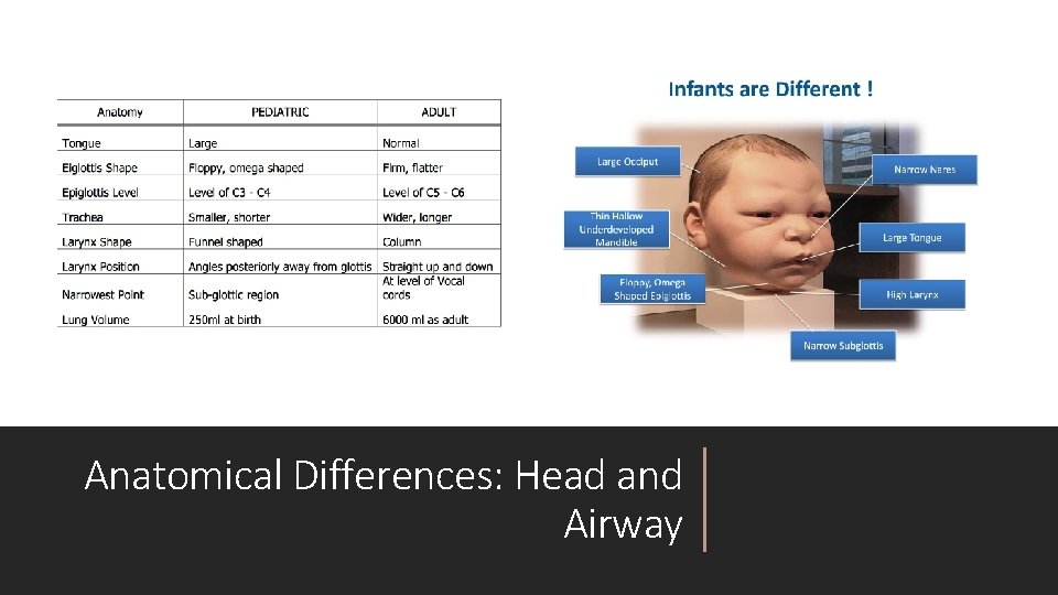 Anatomical Differences: Head and Airway 