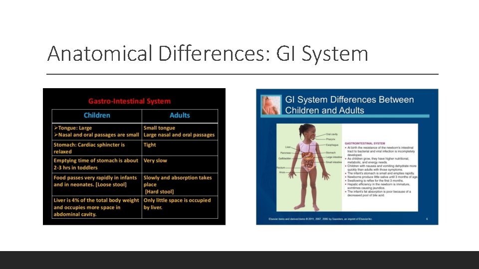 Anatomical Differences: GI System 