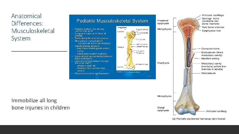 Anatomical Differences: Musculoskeletal System Immobilize all long bone injuries in children 