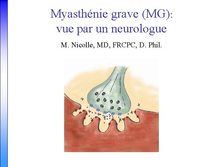 Myasthénie grave (MG): vue par un neurologue M. Nicolle, MD, FRCPC, D. Phil. 