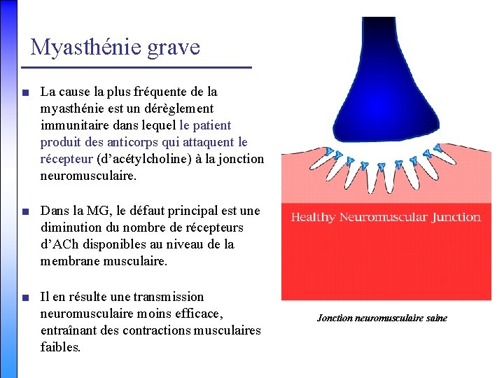 Myasthénie grave ■ La cause la plus fréquente de la myasthénie est un dérèglement