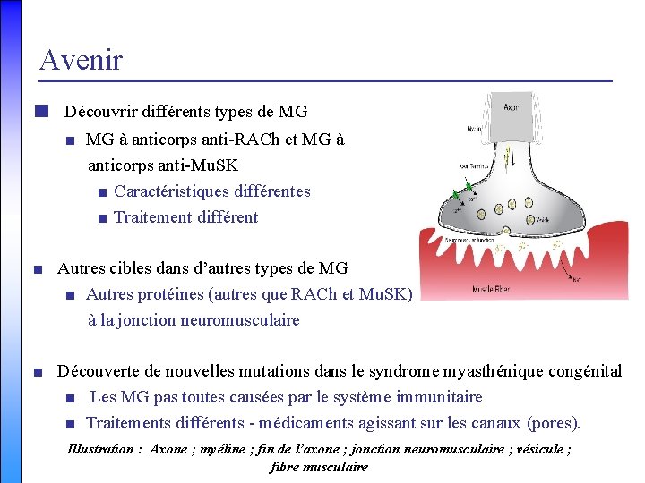 Avenir ■ Découvrir différents types de MG ■ MG à anticorps anti-RACh et MG