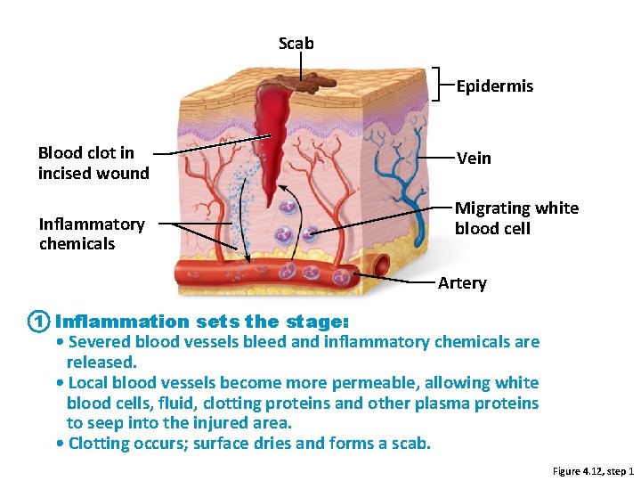 Scab Epidermis Blood clot in incised wound Inflammatory chemicals Vein Migrating white blood cell