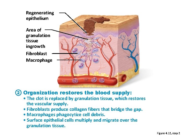 Regenerating epithelium Area of granulation tissue ingrowth Fibroblast Macrophage 2 Organization restores the blood