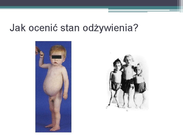 Jak ocenić stan odżywienia? 