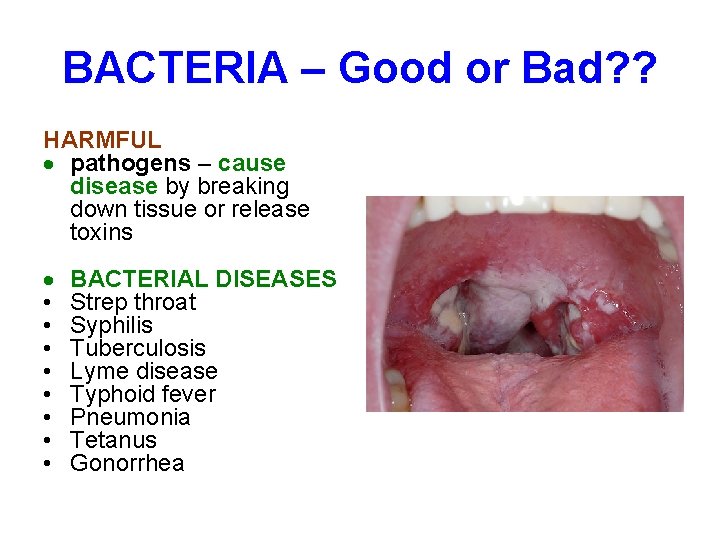 BACTERIA – Good or Bad? ? HARMFUL pathogens – cause disease by breaking down