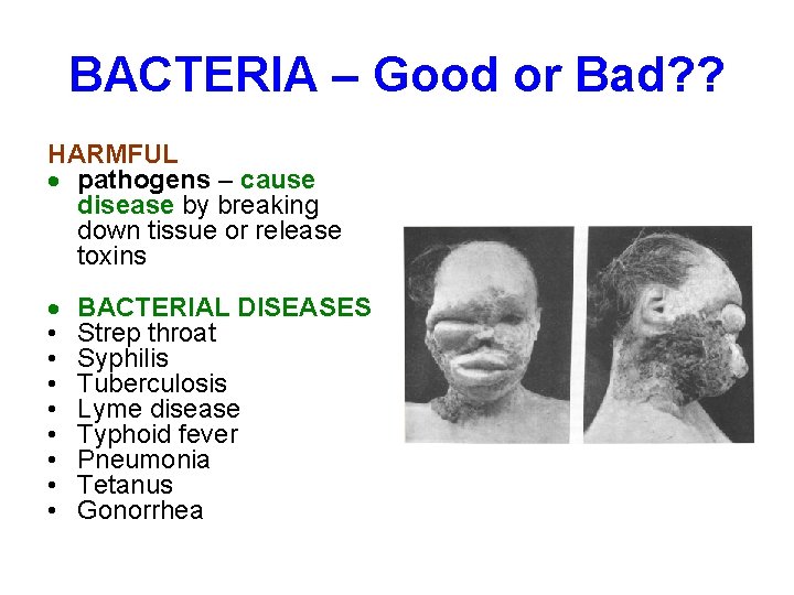 BACTERIA – Good or Bad? ? HARMFUL pathogens – cause disease by breaking down