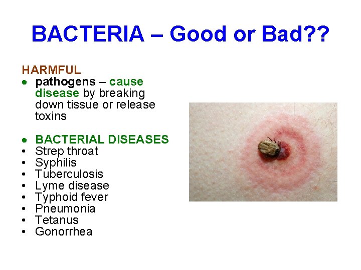 BACTERIA – Good or Bad? ? HARMFUL pathogens – cause disease by breaking down