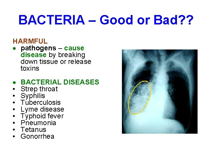 BACTERIA – Good or Bad? ? HARMFUL pathogens – cause disease by breaking down