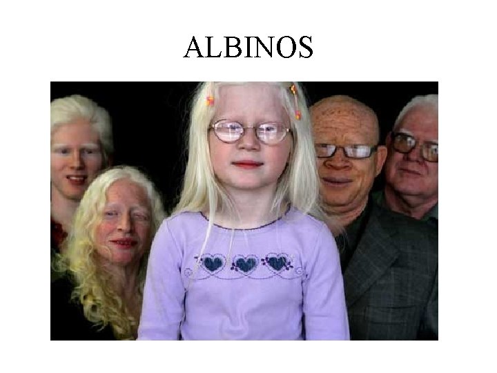 ALBINOS 