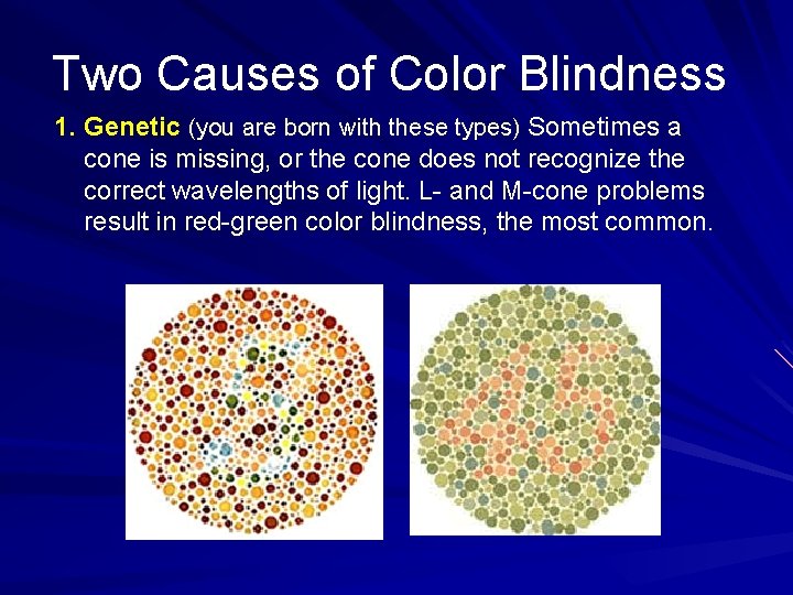 Two Causes of Color Blindness 1. Genetic (you are born with these types) Sometimes