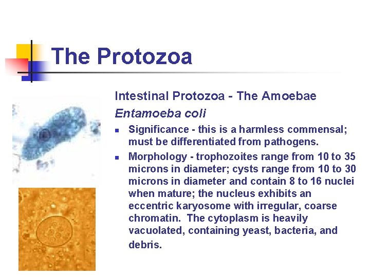 The Protozoa Intestinal Protozoa - The Amoebae Entamoeba coli n n Significance - this The Protozoa Intestinal Protozoa - The Amoebae Entamoeba coli n n Significance - this