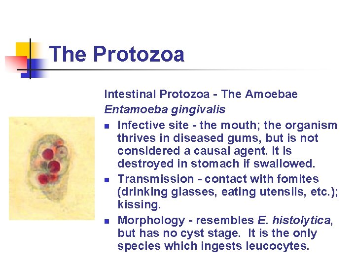 The Protozoa Intestinal Protozoa - The Amoebae Entamoeba gingivalis n Infective site - the