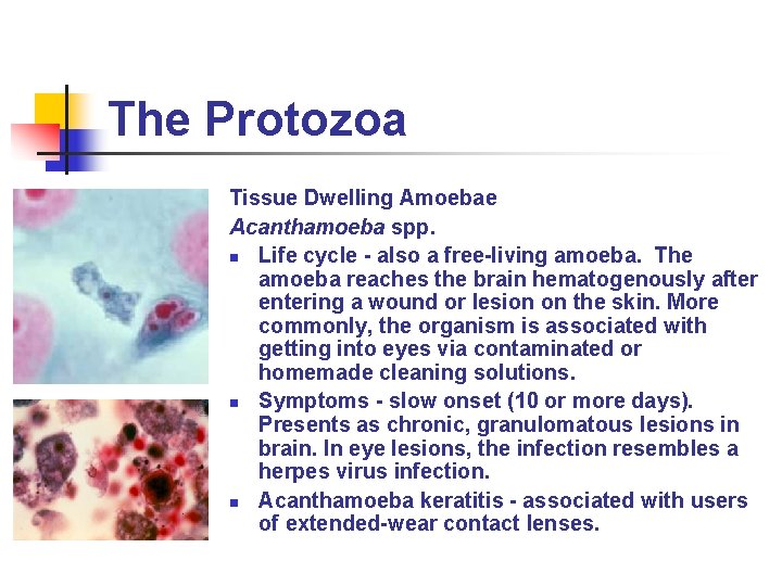 The Protozoa Tissue Dwelling Amoebae Acanthamoeba spp. n Life cycle - also a free-living The Protozoa Tissue Dwelling Amoebae Acanthamoeba spp. n Life cycle - also a free-living