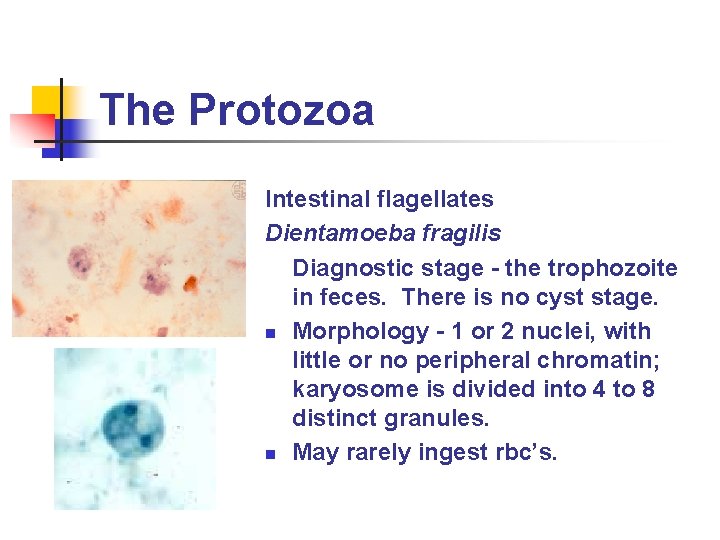 The Protozoa Intestinal flagellates Dientamoeba fragilis Diagnostic stage - the trophozoite in feces. There The Protozoa Intestinal flagellates Dientamoeba fragilis Diagnostic stage - the trophozoite in feces. There