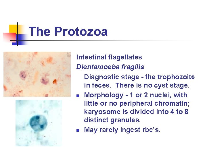 The Protozoa Intestinal flagellates Dientamoeba fragilis Diagnostic stage - the trophozoite in feces. There