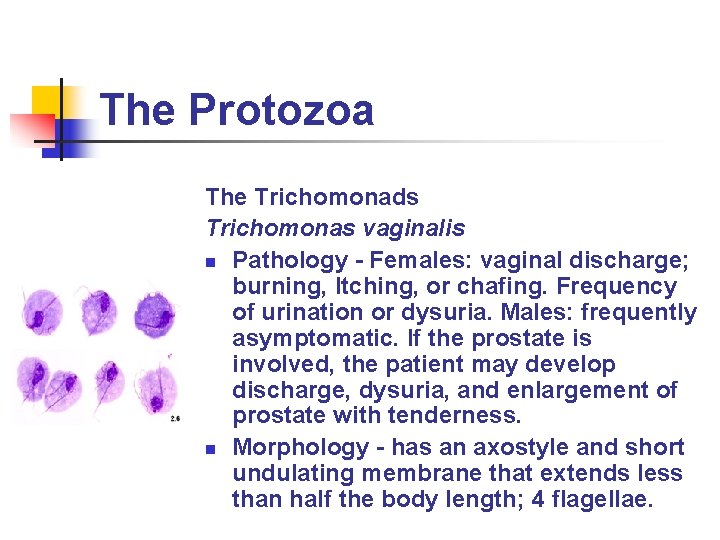 The Protozoa The Trichomonads Trichomonas vaginalis n Pathology - Females: vaginal discharge; burning, Itching, The Protozoa The Trichomonads Trichomonas vaginalis n Pathology - Females: vaginal discharge; burning, Itching,