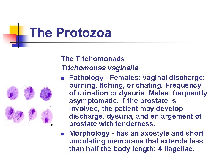 The Protozoa The Trichomonads Trichomonas vaginalis n Pathology - Females: vaginal discharge; burning, Itching,