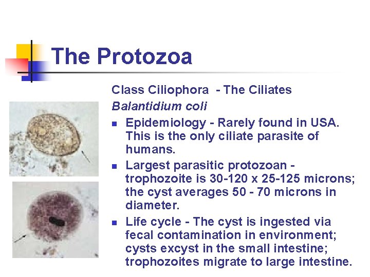 The Protozoa Class Ciliophora - The Ciliates Balantidium coli n Epidemiology - Rarely found The Protozoa Class Ciliophora - The Ciliates Balantidium coli n Epidemiology - Rarely found