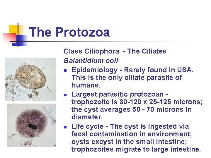 The Protozoa Class Ciliophora - The Ciliates Balantidium coli n Epidemiology - Rarely found