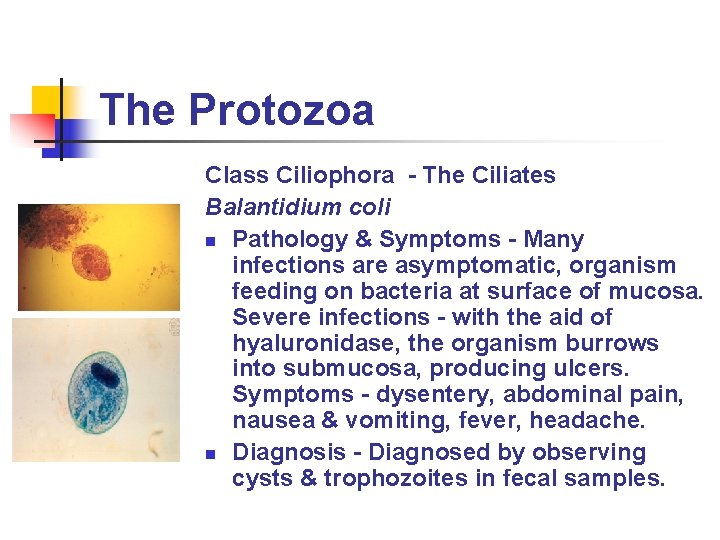 The Protozoa Class Ciliophora - The Ciliates Balantidium coli n Pathology & Symptoms -