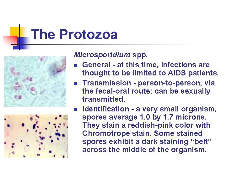 The Protozoa Microsporidium spp. n General - at this time, infections are thought to The Protozoa Microsporidium spp. n General - at this time, infections are thought to