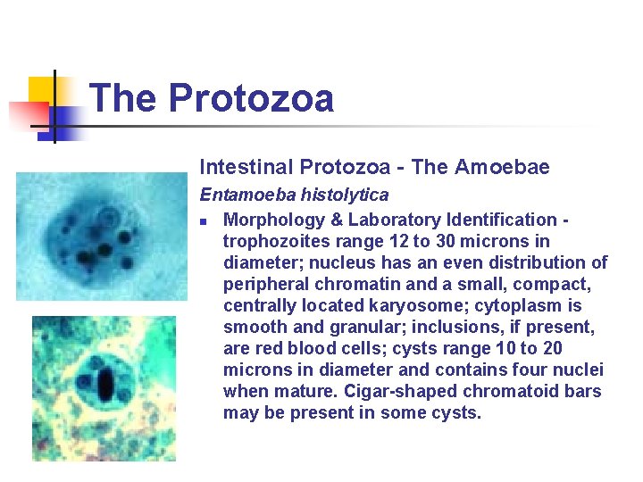 The Protozoa Intestinal Protozoa - The Amoebae Entamoeba histolytica n Morphology & Laboratory Identification The Protozoa Intestinal Protozoa - The Amoebae Entamoeba histolytica n Morphology & Laboratory Identification