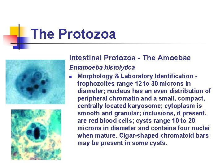 The Protozoa Intestinal Protozoa - The Amoebae Entamoeba histolytica n Morphology & Laboratory Identification