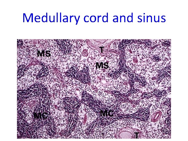 Medullary cord and sinus 