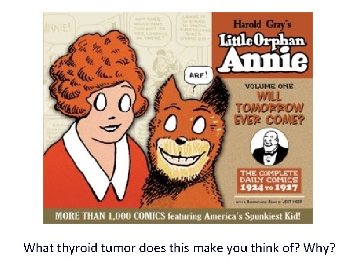 What thyroid tumor does this make you think of? Why? 