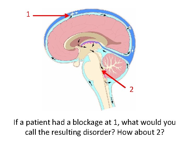 1 2 If a patient had a blockage at 1, what would you call