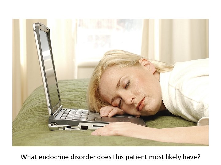 What endocrine disorder does this patient most likely have? 