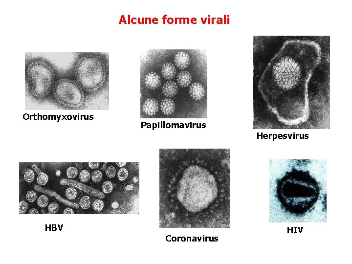 Alcune forme virali Orthomyxovirus Papillomavirus Herpesvirus HBV Coronavirus HIV 