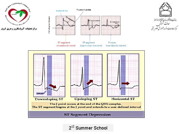 2 st Summer School 