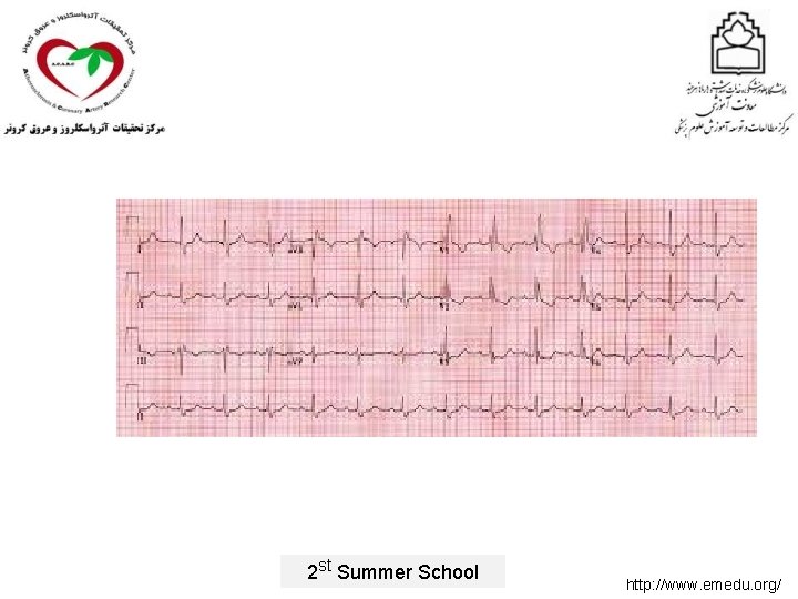 2 st Summer School http: //www. emedu. org/ 