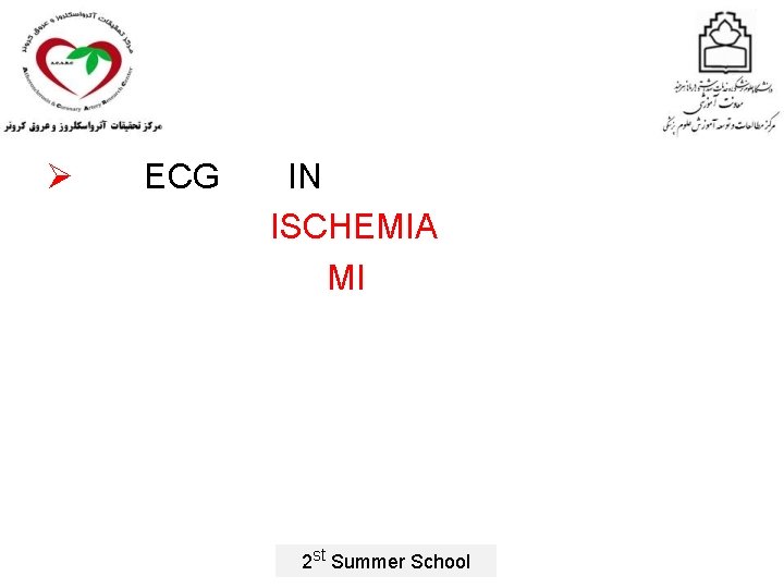 Ø ECG IN ISCHEMIA MI 2 st Summer School 