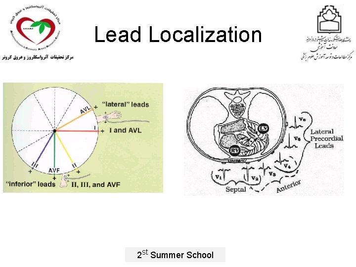 Lead Localization 2 st Summer School 