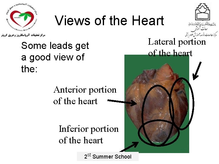 Views of the Heart Some leads get a good view of the: Anterior portion