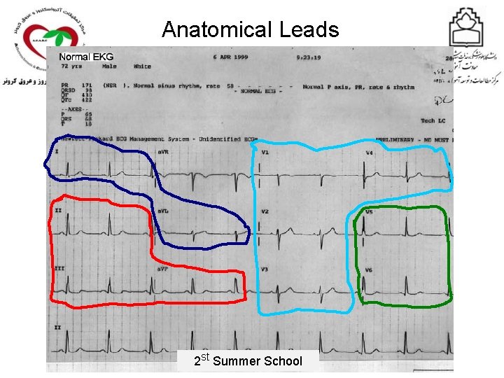 Anatomical Leads 2 st Summer School 