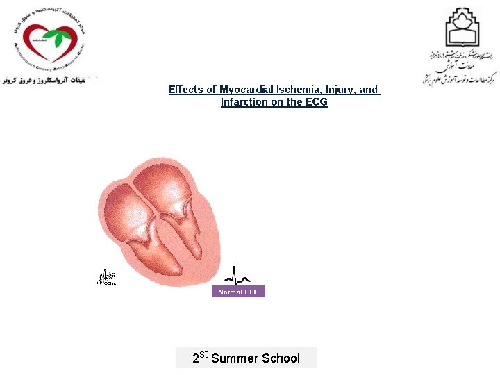 2 st Summer School 