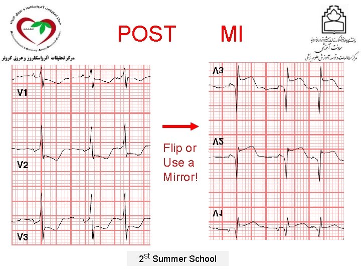 POST Flip or Use a Mirror! 2 st Summer School MI 