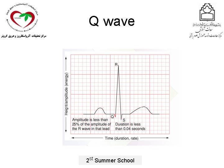 Q wave 2 st Summer School 