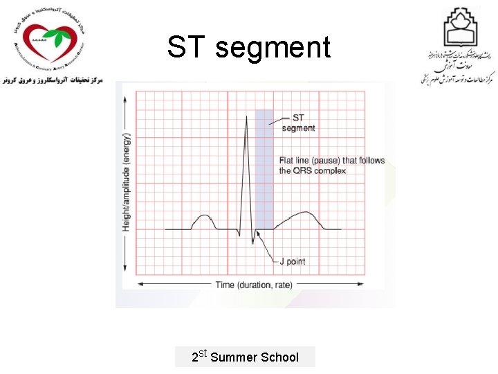 ST segment 2 st Summer School 