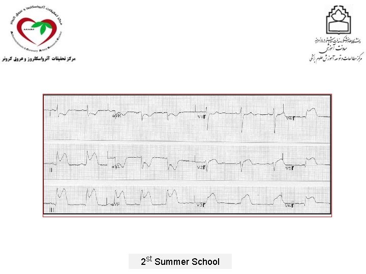 2 st Summer School 