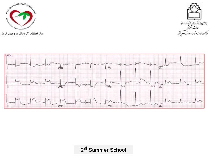 2 st Summer School 