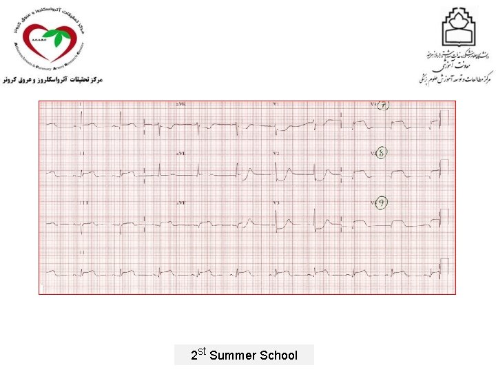 2 st Summer School 