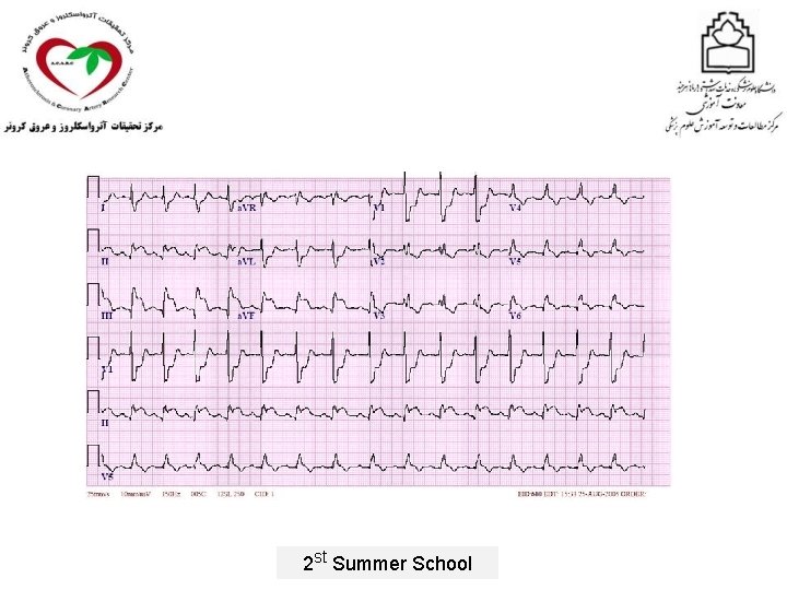 2 st Summer School 