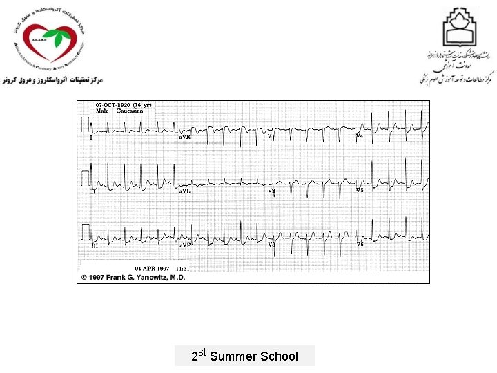 2 st Summer School 