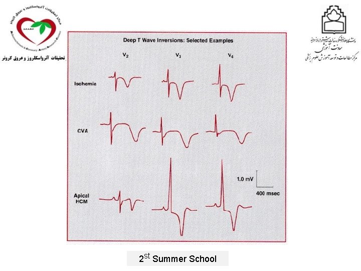 2 st Summer School 